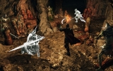 1405457667-difficult-area 1405457667-difficult-area