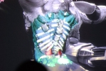 xray2 xray2